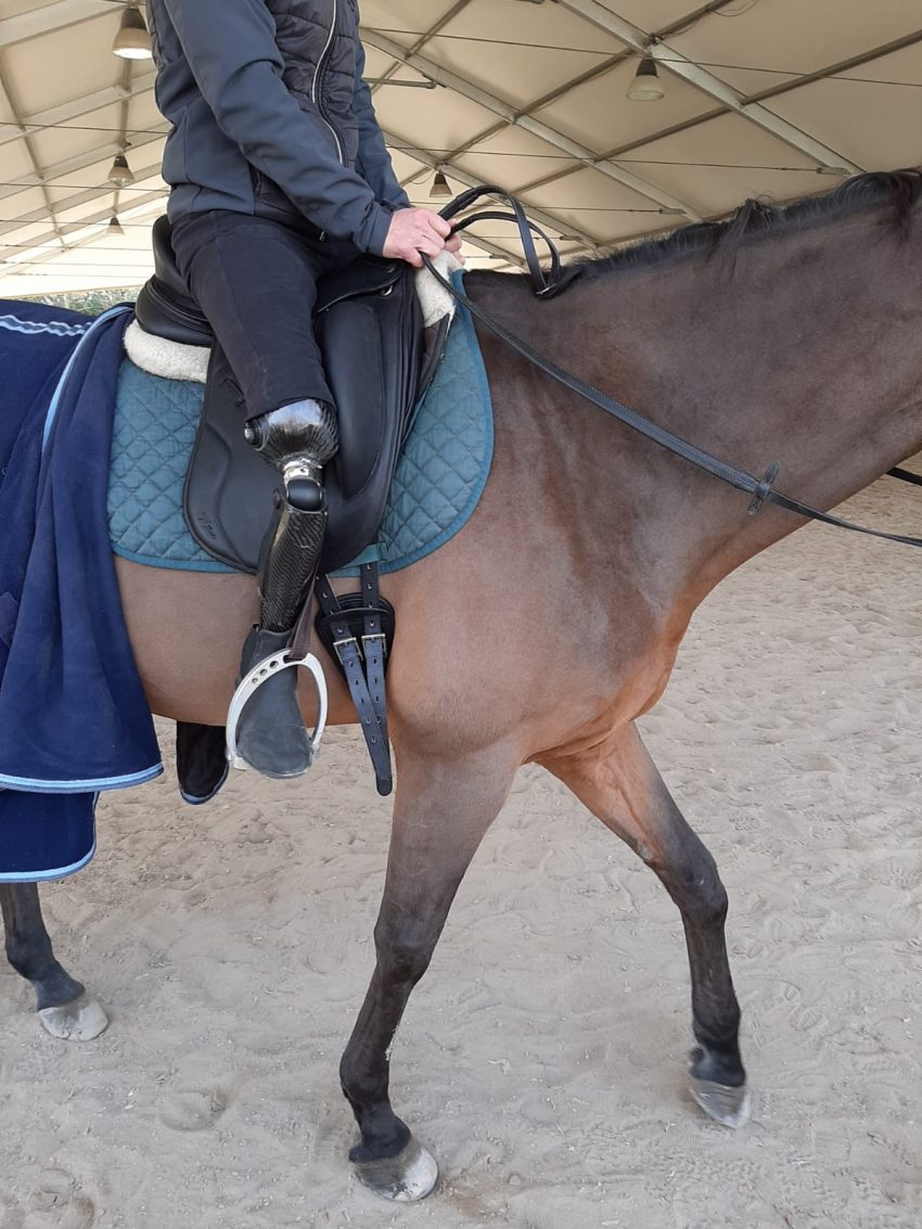 amputazioni degli arti inferiori